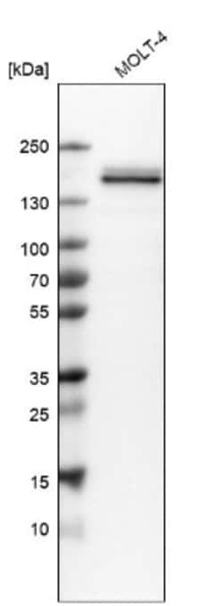 HA-1 Antibody, Novus Biologicals 25 &mu;L; Unlabeled:Antibodies, Polyclonal